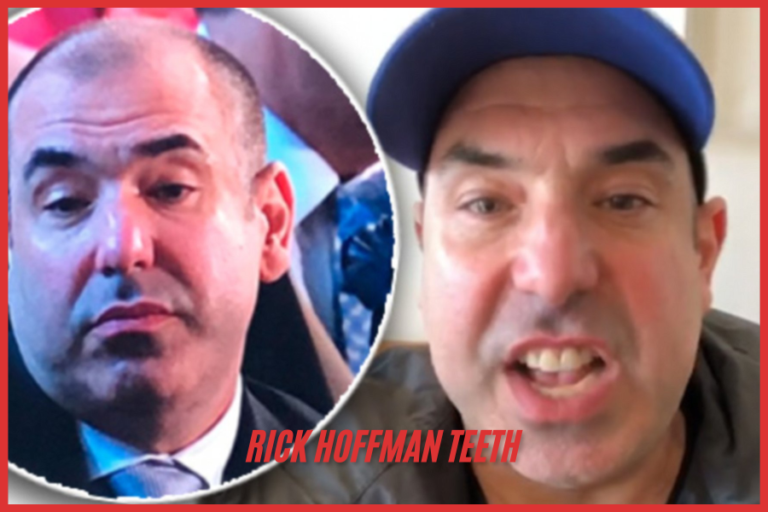 rick hoffman teeth